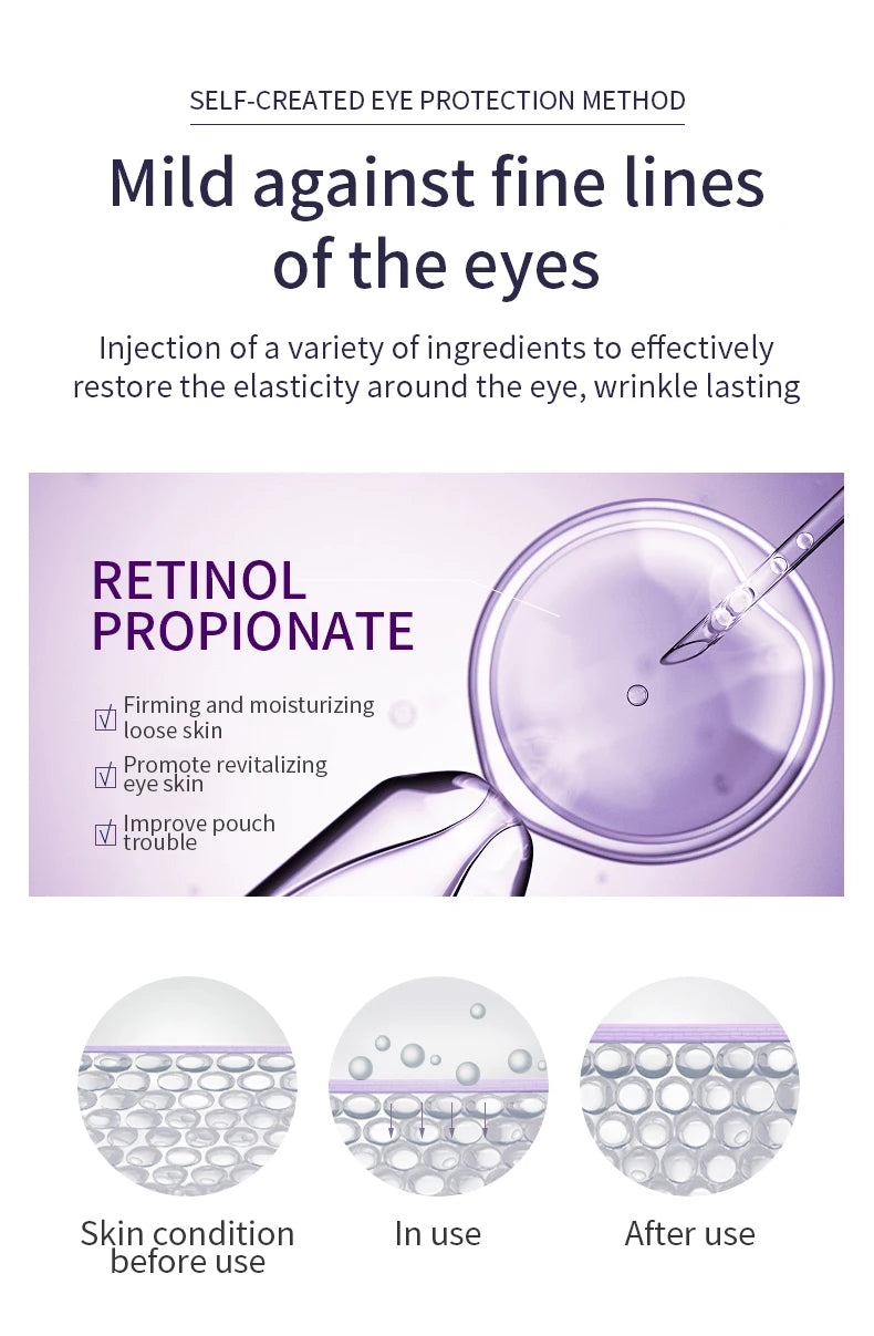 O'CHEAL Anti Wrinkle Anti Aging Hyaluronic Acid Eye Skin Care