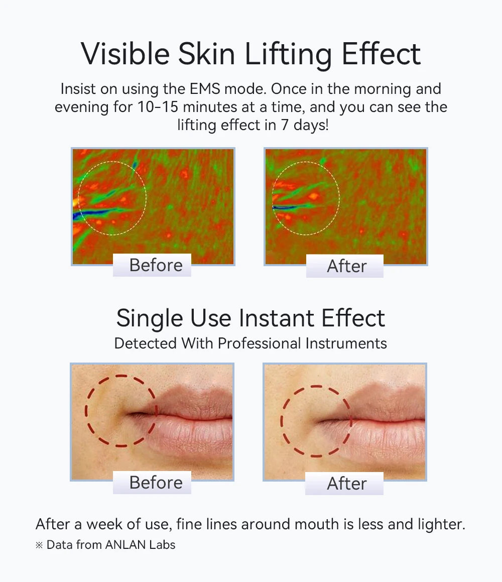 ANLAN Microcurrent Face Lifting Massager