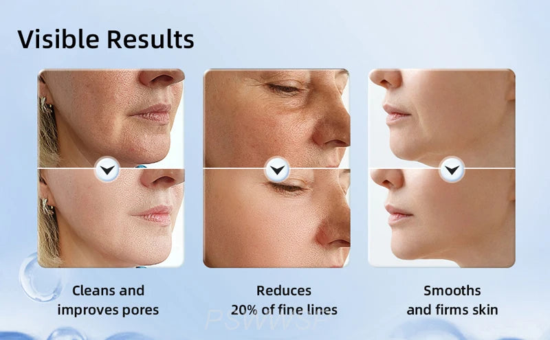 Photon Therapy Neck & Face Lifting Device